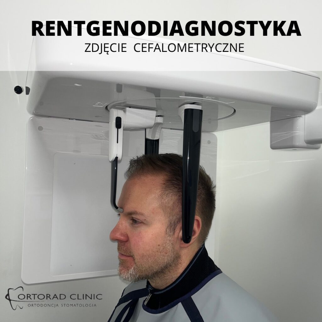 RTG cefalometryczne